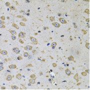 abx000657