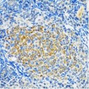 Immunohistochemistry of paraffin-embedded Rat ovary using SIRT2 Antibody (1/100 dilution, 40x lens).