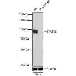 Signal Transducer And Activator of Transcription 5B (STAT5B) Antibody