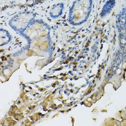 Signal Transducer And Activator of Transcription 5B (STAT5B) Antibody