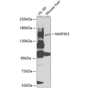 Western blot analysis of extracts of various cell lines using MAP3K5 Antibody (1/1000 dilution).