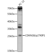 Western blot analysis of extracts of PC-12 cells using CDKN1B/p27KIP1 Antibody (1/1000 dilution).