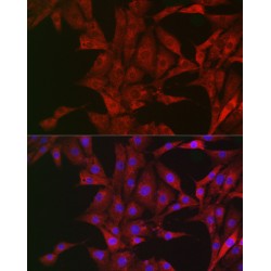 Bcl2 Like Protein 11 (BCL2L11) Antibody