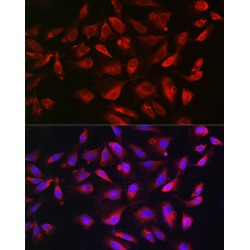 Bcl2 Like Protein 11 (BCL2L11) Antibody