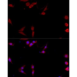 Cluster of Differentiation 40 Ligand / TNFSF5 (CD40LG) Antibody