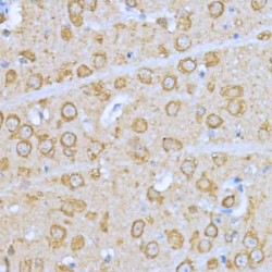 Heat Shock Protein 90 kDa Alpha A1 (HSP90AA1) Antibody