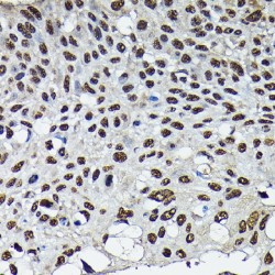Cyclin-Dependent Kinase 4 (CDK4) Antibody