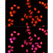 Immunofluorescence analysis of HeLa cells using XRCC1 Antibody (1/100 dilution, 40x lens). Blue: DAPI for nuclear staining.