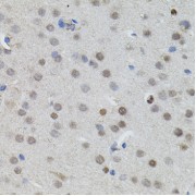 Immunohistochemistry of paraffin-embedded Mouse brain using MYCN Antibody