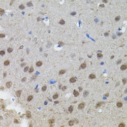 N-Myc Proto-Oncogene Protein (MYCN) Antibody