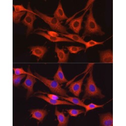 Dynamin-2 (DNM2) Antibody
