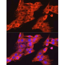 Dynamin-2 (DNM2) Antibody