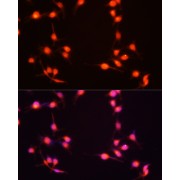 Immunofluorescence analysis of U-251MG cells using S100B Antibody (1/100 dilution, 20x lens). Blue: DAPI for nuclear staining.