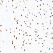 Immunohistochemistry of paraffin-embedded Mouse brain using GATA2 Antibody (1/100 dilution, 40x lens).