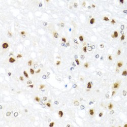 GATA Binding Protein 2 (GATA2) Antibody