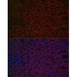Bone Morphogenetic Protein 7 (BMP7) Antibody