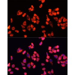 Angiopoietin-2 (ANGPT2) Antibody