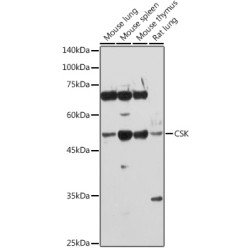 Tyrosine-Protein Kinase CSK (CSK) Antibody