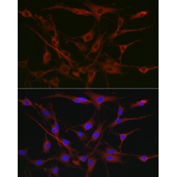 Tyrosine-Protein Kinase CSK (CSK) Antibody