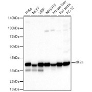 Western blot analysis of various lysates using eIF2α Antibody (1/500 dilution).