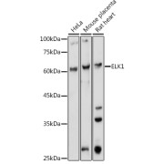 Western blot analysis of extracts of various cell lines using ELK1 Antibody (1/1000 dilution).