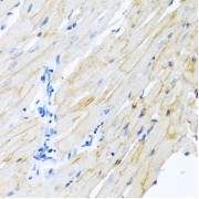 Immunohistochemistry of paraffin-embedded Rat heart using ADAM17 Antibody (1/100 dilution, 40x lens).