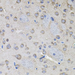 NF-Kappa-B Essential Modulator (IKBKG) Antibody