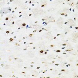 Splicing Factor Proline And Glutamine Rich (SFPQ) Antibody