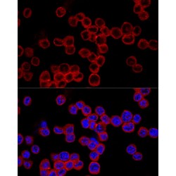 Caspase 1 (CASP1) Antibody