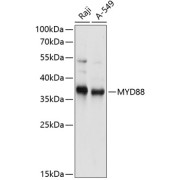 Western blot analysis of extracts of various cell lines using MYD88 Antibody (1/1000 dilution).