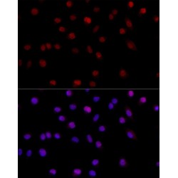 G/T Mismatch-Binding Protein (MSH6) Antibody