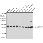 Western blot analysis of extracts of various cell lines using DJ-1/PARK7 Antibody (1/1000 dilution).