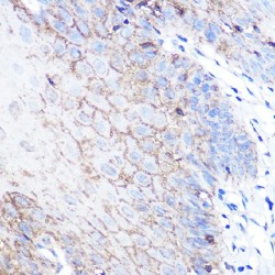 High Sensitive Parkinson Disease Protein 7 (PARK7) Antibody