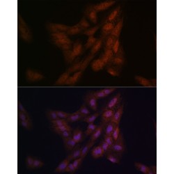 High Sensitive Parkinson Disease Protein 7 (PARK7) Antibody