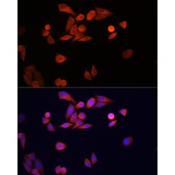 High Sensitive Parkinson Disease Protein 7 (PARK7) Antibody