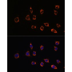 High Sensitive Parkinson Disease Protein 7 (PARK7) Antibody