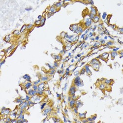 Endoplasmin (HSP90B1) Antibody
