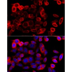 Endoplasmin (HSP90B1) Antibody