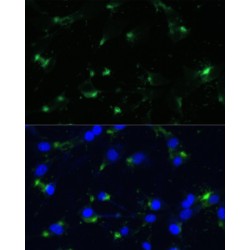 Alpha-Enolase (ENO1) Antibody