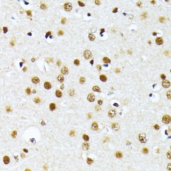 Protein Arginine N-Methyltransferase 1 (PRMT1) Antibody