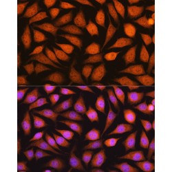 14-3-3 Protein Epsilon (YWHAE) Antibody