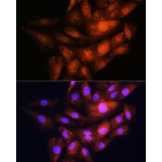 Immunofluorescence analysis of H9C2 cells using YWHAE Antibody (1/100 dilution). Blue: DAPI for nuclear staining.
