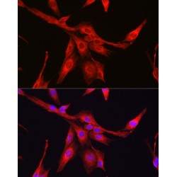 Glutathione Synthetase (GSS) Antibody