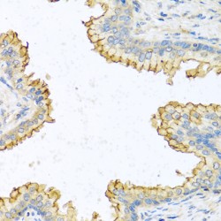 Ribonuclease 13 (RNASE13) Antibody