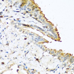 Ribonuclease 13 (RNASE13) Antibody