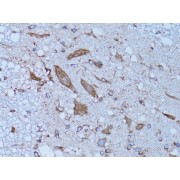 Immunohistochemistry of paraffin-embedded Rat spinal cord using HADH Antibody (1/100 dilution, 40x lens).