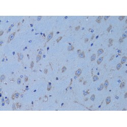 Hydroxyacyl-CoA Dehydrogenase (HADH) Antibody