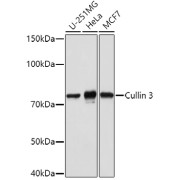abx001001