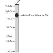 abx001003