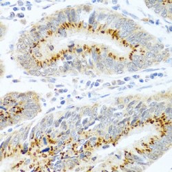 Protein FAM3B (FAM3B) Antibody